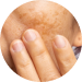 pediatric dermatology