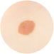 pediatric dermatology