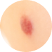 pediatric dermatology