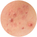 MEDICAL DERMATOLOGY