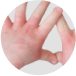 MEDICAL DERMATOLOGY