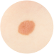 MEDICAL DERMATOLOGY