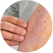 MEDICAL DERMATOLOGY