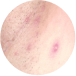 MEDICAL DERMATOLOGY