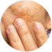 MEDICAL DERMATOLOGY