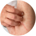 MEDICAL DERMATOLOGY