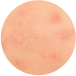 MEDICAL DERMATOLOGY