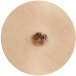 MEDICAL DERMATOLOGY