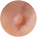 MEDICAL DERMATOLOGY