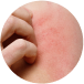 MEDICAL DERMATOLOGY